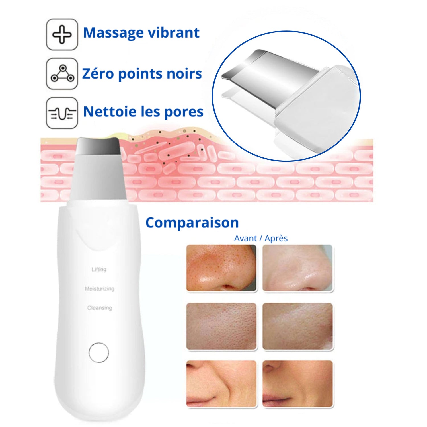 Épurateur de peau à ultrasons – Nettoyage profond, élimination des points noirs et soin du visage